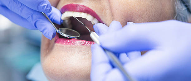 Best Dental Abscess Treatment in Hawthorn Woods, IL