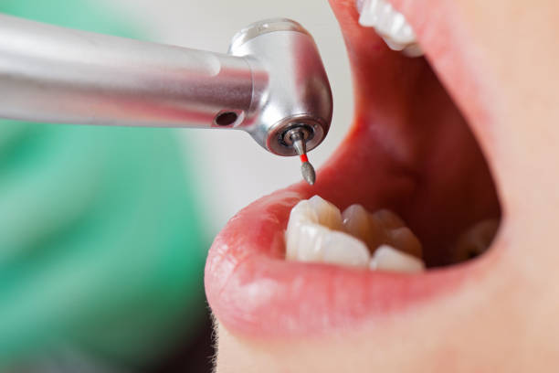 Best Emergency Treatment for Oral Infections in Hawthorn Woods, IL